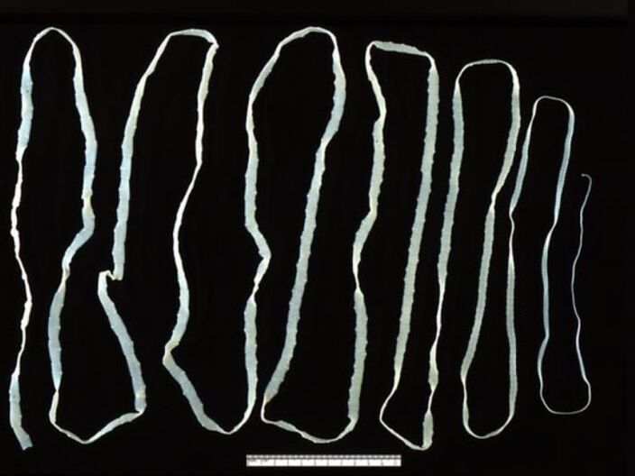 Cattle tapeworm