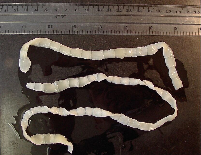 broad tapeworm in the human body